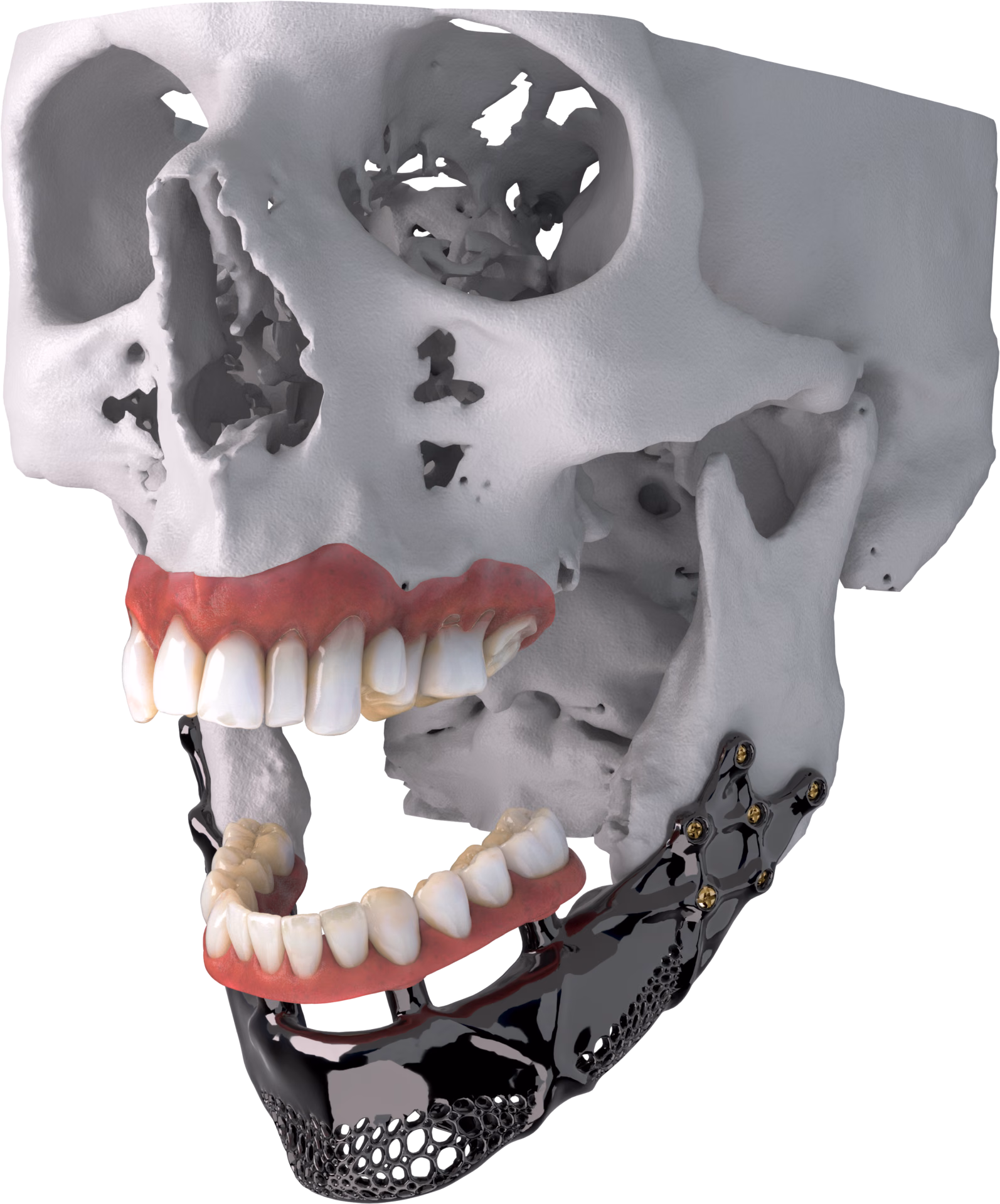 Cranio-maxillofacial solution area